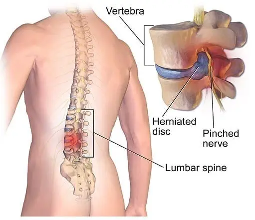 5f3c59e30354fe1bc48266d9f74e8593